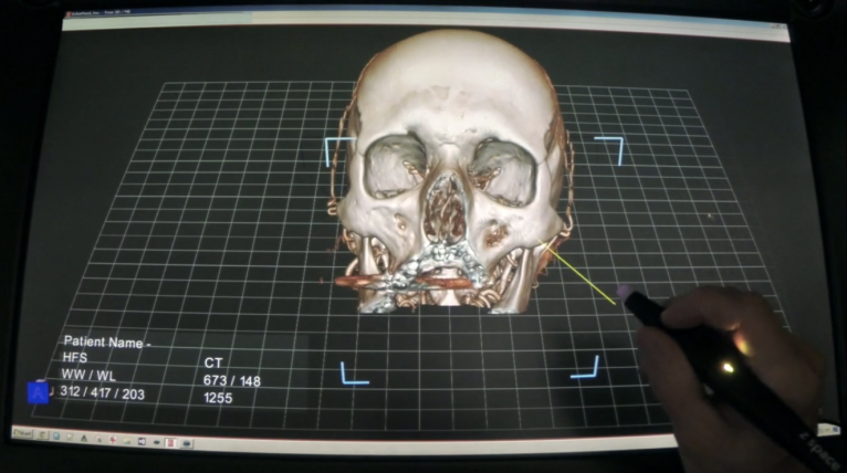 This system uses augmented reality to help prepare surgeons for operations
