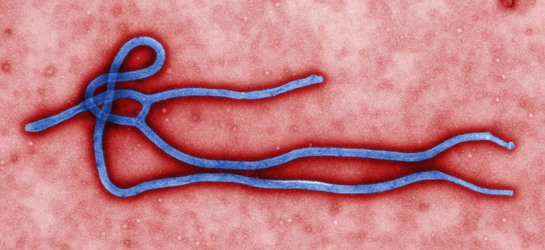 Don’t Panic: First Case of Sexually Transmitted Ebola Just Confirmed