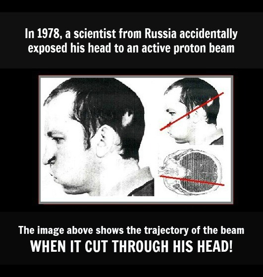 Your Hand vs. a Proton Beam – Who Wins?
