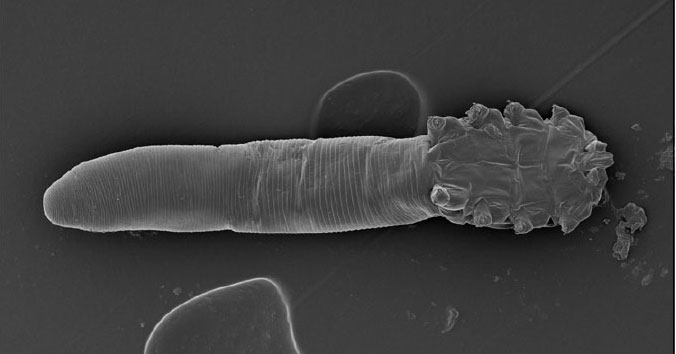 Eyelash Mites: The Creatures that Eat, Mate, and Die on Your Face