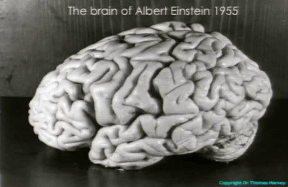 The Myth of Einstein’s Brain and How it Differs from the Norm
