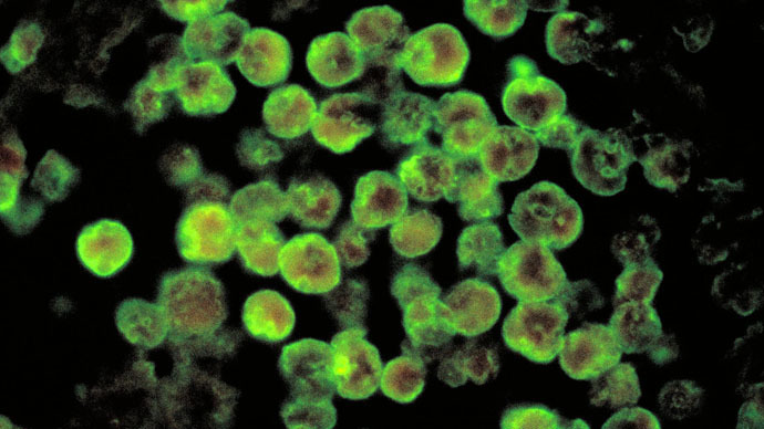 Boy Killed by Brain-Eating Amoeba in Tap Water: First Confirmed Case