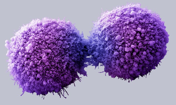 New Discovery Could Give Scientists a Way to Destroy Cancer Cells