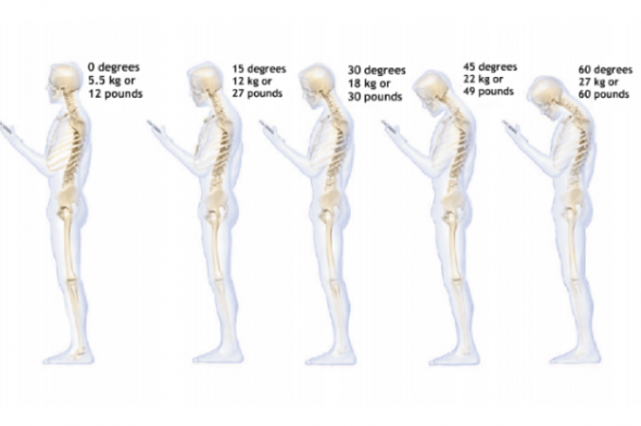 Study Shows What Cell Phone Use Does To Our Necks
