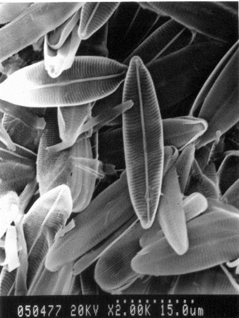 Genetically Engineered Algae Kills Cancer Cells Without Harming Healthy Cells