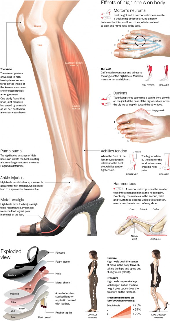 How Do High Heels Impact the Human Body? (infographic)