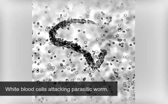 Watch: The War Inside Your Body