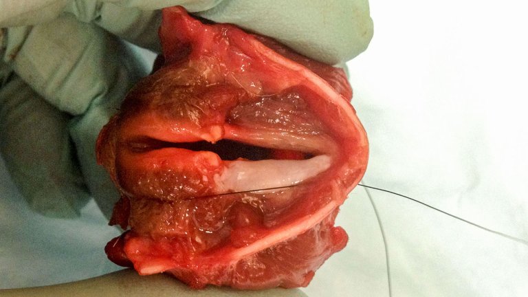 Scientists Grow Vocal Cord Tissue in a Lab for the First Time, and It Produces Sound