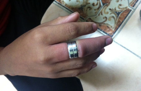 Medical Advice on How To Remove A Stuck Ring (In Under 2 Minutes) (Video)