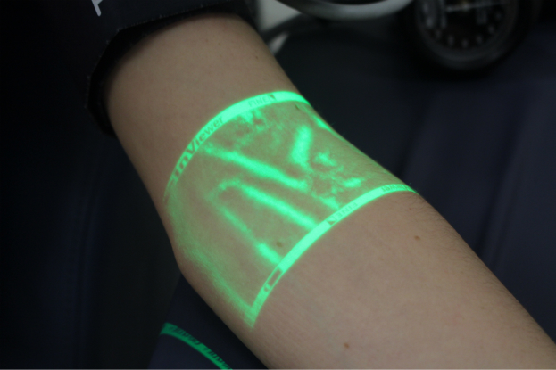 New Technology Shows Nurses Where Your Veins Are
