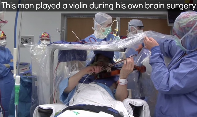 Man Plays Violin During His Own Brain Surgery