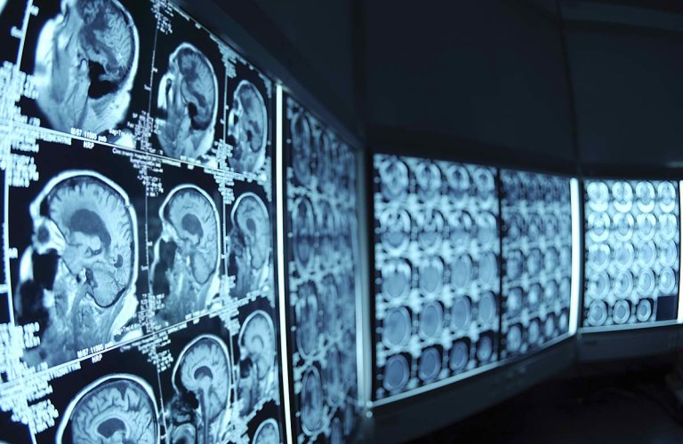 Enlitic Raises $10 Million to Fund Medical Deep Learning Technology