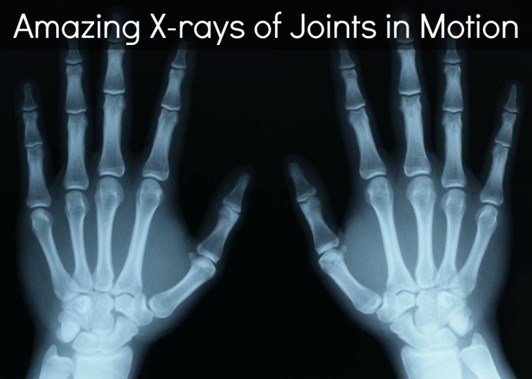 X-Rays Show Human Joints In Motion