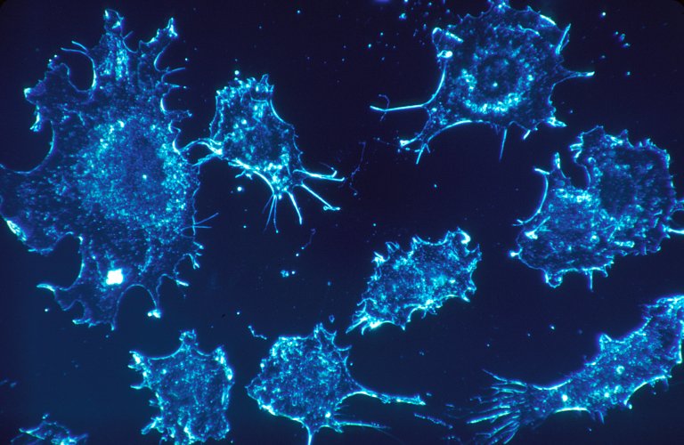 New Dialysis-Style Treatment ‘Washes’ Blood of Cancer Cells