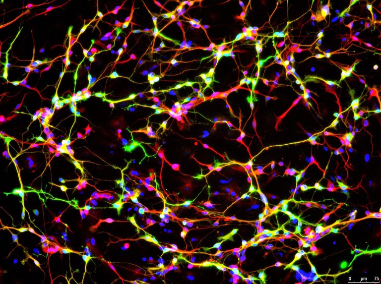 Researchers Reprogram Genome to Produce More Dopamine