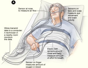 National Heart Lung and Blood Institute (NIH)