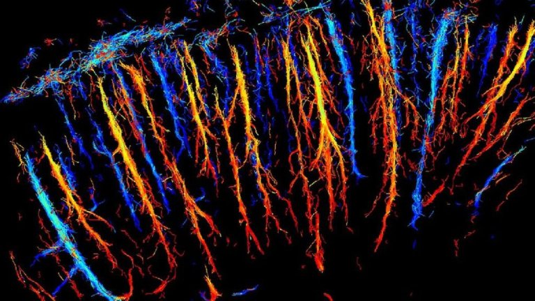 Ultrasound Used to Capture 3D Images of a Live Rat Brain