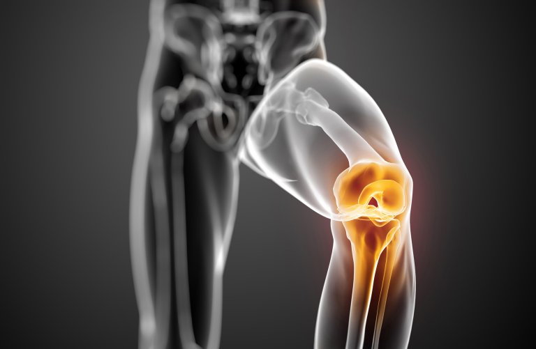 A New “Shock Absorber” for Knees Has Just Been Developed