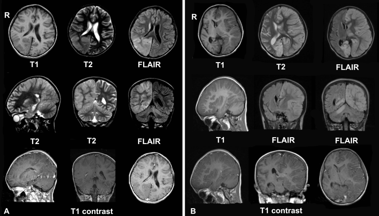 Scientists Successfully Decode Thoughts, Reading Individuals’ Minds in Real-Time