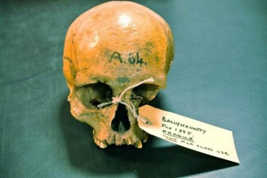 skull