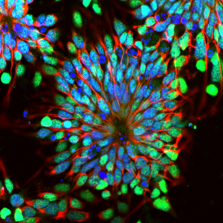 New Algorithm May Someday Enable Scientists to Regrow Limbs and Replace Damaged Organs