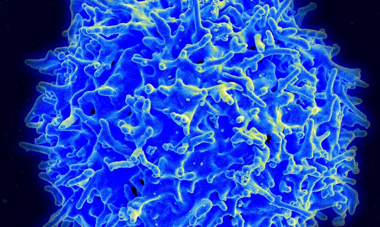 T-Cell Therapy Leads to “Extraordinary Results” for Cancer Patients in Early Clinical Trials