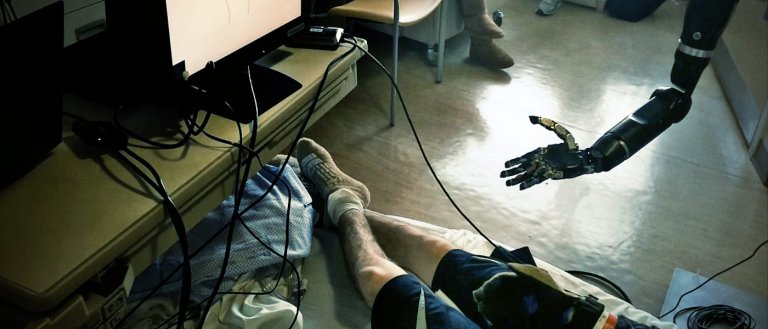 Prosthetic Arm Controlled by the Mind Can Move its Fingers