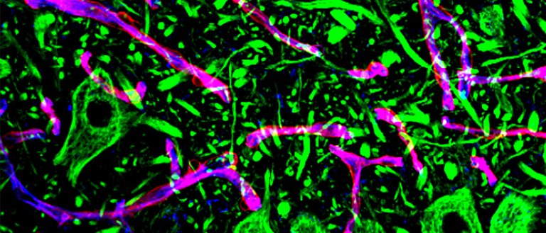 Researchers Develop Therapy to Halt Progression of ALS in Mice