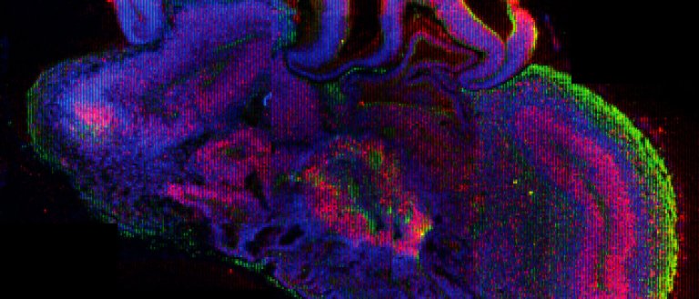 Scientists Have Created Miniature Versions of the Human Brain Using Skin Cells