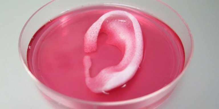 The First 3D Bioprinter That Can Print Body Parts for Large Scale Human Implantation