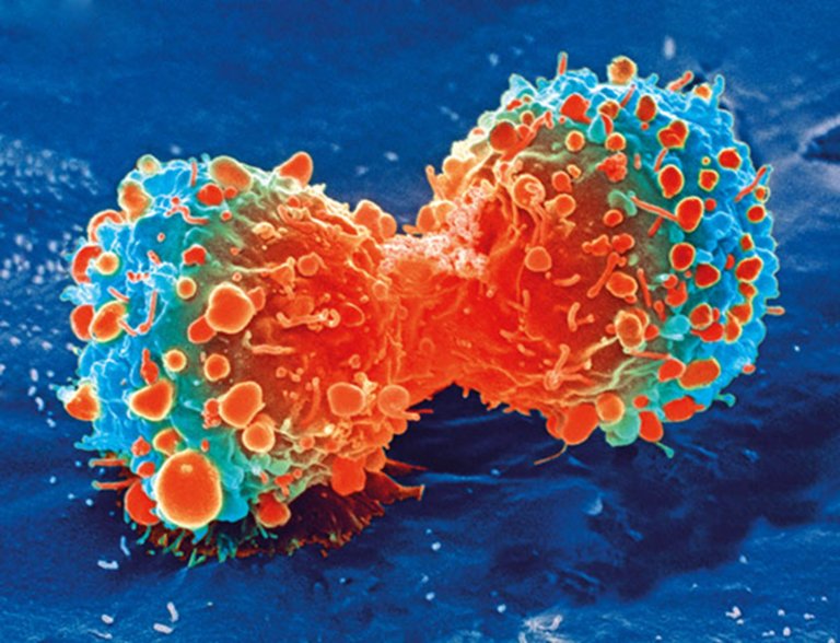 Scientists Create Artificial Intelligence to Help Fight Cancer