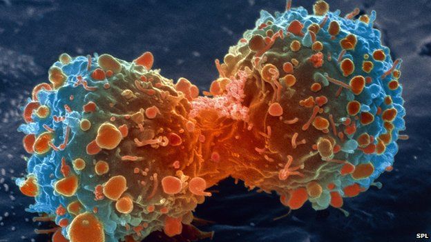 Cancer cell division. Credit: SPL