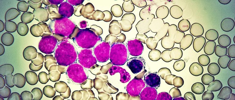 Scientists Think They’ve Discovered Why Skin Cells Age