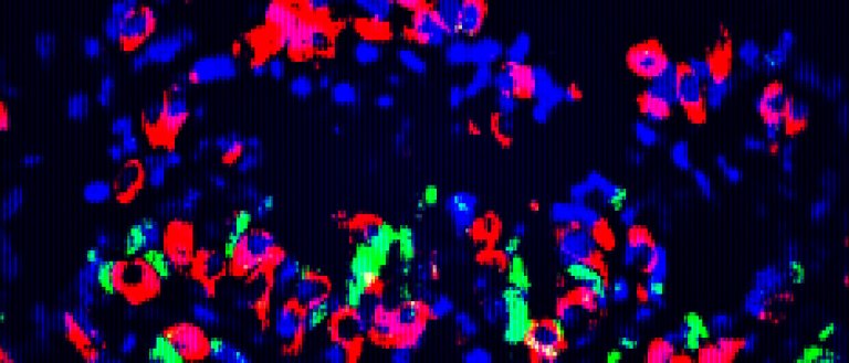 Regenerative Biology: Harvard Scientists Create Mini-Organs Capable of Producing Insulin