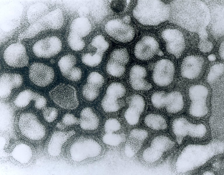 New Biosensor Rapidly Detects Multiple Viruses, and is 80% Cheaper Than Current Methods