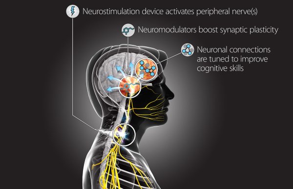 The Targeted Neuroplasticity Training (TNT) program will use a suite of techniques to stimulate the peripheral nervous system and "reprogram" the brain to learn new skills. Credit: Defense Advanced Research Projects Agency