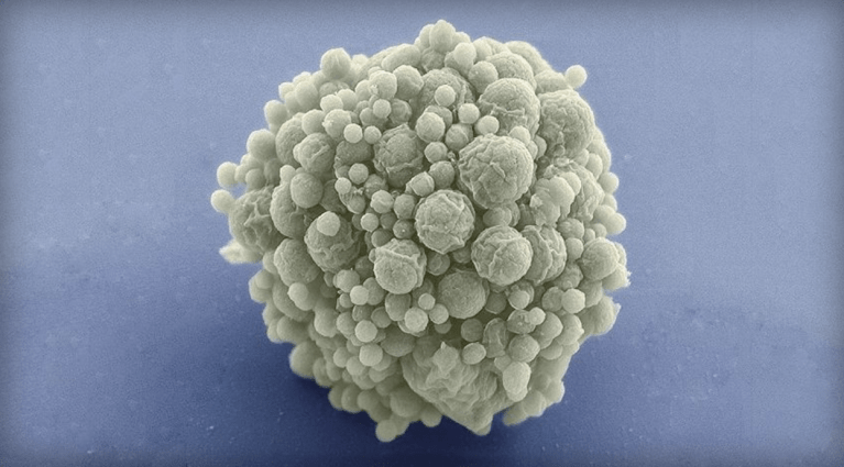 Scientists Find Microbe Grows 60% Better in Space Than on Earth
