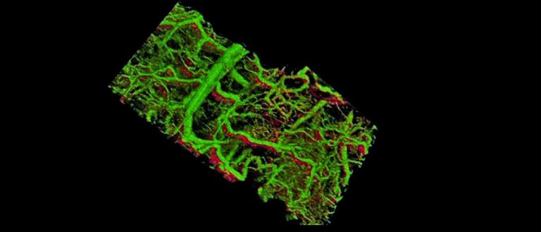 New Tech Lets You See Under Your Skin in 3D