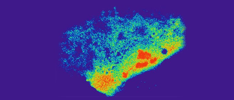 CRISPR Gene Editing Allows Scientists to Target RNA in Live Cells