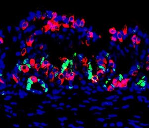 Engineered gastric mini organ. Image Credit: Chaiyaboot Ariyachet