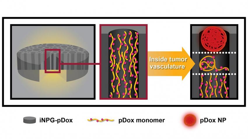 Silicon particles (iNPG) carry stringlike polymers loaded with a chemotherapy compound called doxorubicin (p-Dox). Credit: Nature Biotechnology