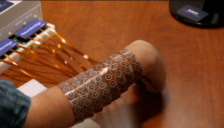 Paralyzed Man Regains Control of His Hand, Thanks to A Chip Implanted in His Brain