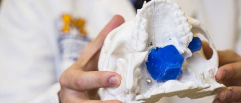A 3D Printed Skull Just Saved a Child’s Life