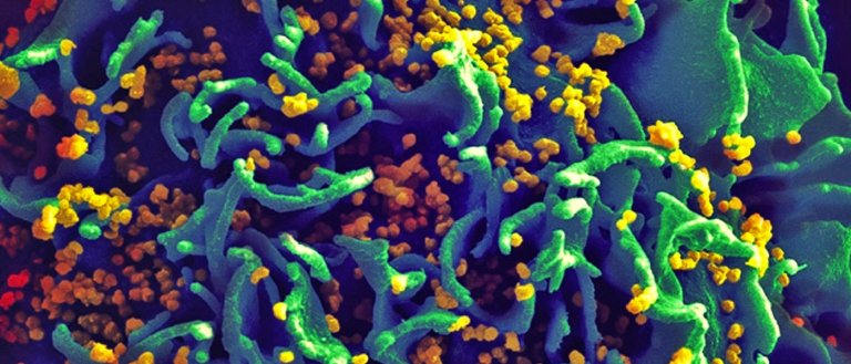 HIV Can Mutate to Evade Attempts To Modify It With CRISPR Gene Editing