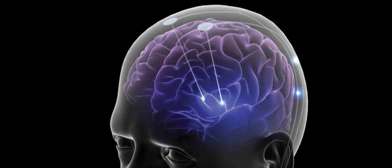 New Device Can Ease Chronic Pain Without Drugs, Thanks to Brain Stimulation