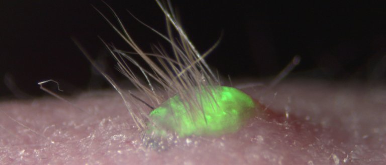 We Can Now Grow Skin Complete with Hair Follicles, Glands, and Nerves