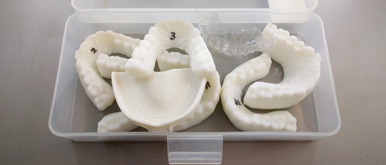 College Student Straightens Own Teeth With 3D Printed Retainers That He Made