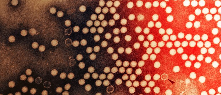 The World Health Organization Will Reportedly Eradicate Polio by Early 2017