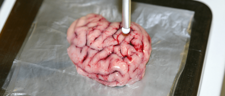 “Smart Scalpel” Can Identify Tumors in Half a Second
