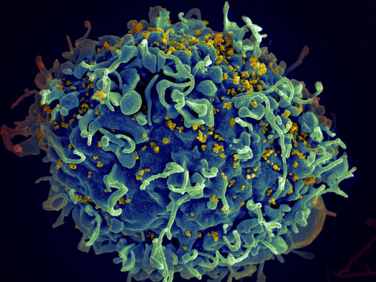 HIV Genes Have Been Cut Out of Live Animals Using CRISPR